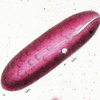 Leucophrys sanguinea (identification uncertain, probably a urostyloid)