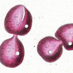 Leucophrys sanguinea (identification uncertain, probably a urostyloid)