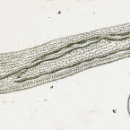 Spirostomum ambiguum (actually a Condylostoma)